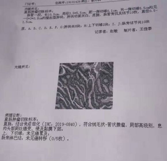 肠镜提示ca，活检病理显示高级别瘤变