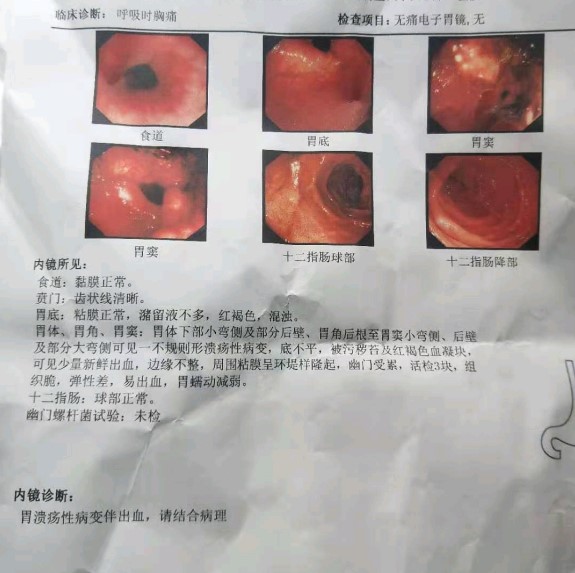 求：中低分化的胃腺癌到底可不可怕？