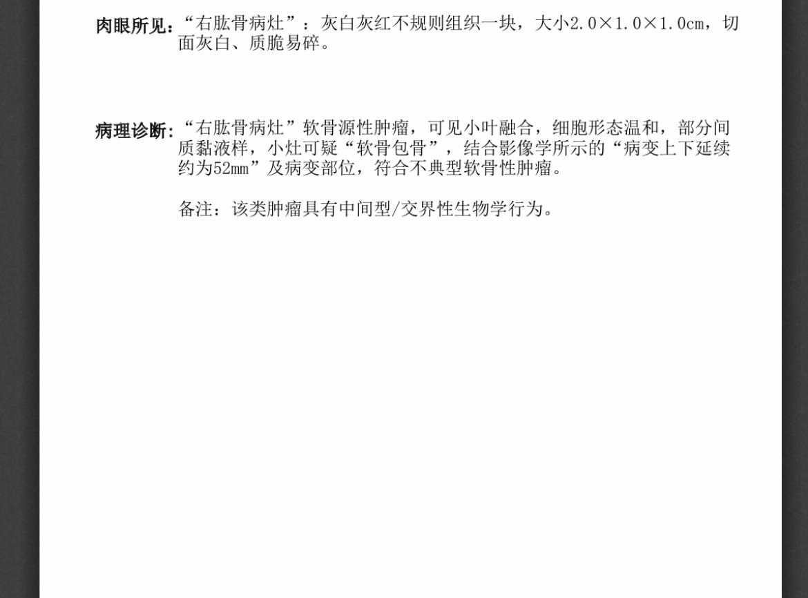 我这是高分化软骨肉瘤？